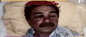 VIDEO / Imagini şocante! Un bărbat din Timişoara, legat de calorifer cu cătuşele şi bătut groaznic