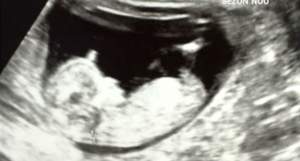 FOTO / Şi-a prezentat ecografia bebeluşului la TV, dar a făcut o gafă de neiertat! Toate mamele îşi vor schimba părerea despre Ilinca Vandici