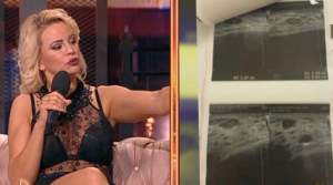 VIDEO / Primele imagini cu nodulii de la sân ai Marianei Roşca: "Unul e chiar pe sfârc"