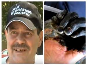 VIDEO / Caz șocant! Un bărbat s-a îmbolnăvit de "moarte neagră" din cauza pisicii! Este incredibil cum arată corpul lui