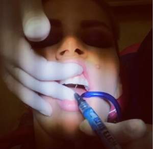 FOTO / Andreea Bănică, de urgenţă pe mâna medicului! A fost accidentată în timpul unui concert: "Să te ţii ce a fost la gura mea"