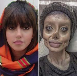 Tânăra care s-a desfigurat ca să arate ca Angelina Jolie şi-a expus adevărata faţă. Aşa arată nemachiată şi fără alte artificii