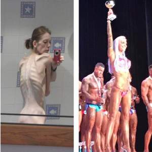 FOTO / Transformarea spectaculoasă a unei tinere anorexice! Cântărea 25 de kilograme, dar acum e campioană la fitness