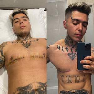 Transformarea lui Lino Golden la un an de la operația la abdomen. Mesajul motivațional al artistului: „Sunt mândru de mine” / FOTO
