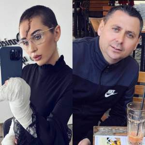 Dana Roba, probleme pe viață după ce a fost bătută cu bestialitate de Daniel Balaciu. Make-up artista nu mai are gust și miros: „Înainte să mă judecați...” / FOTO