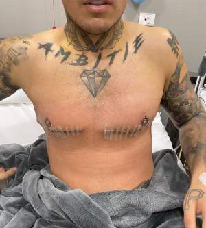 Lino Golden le-a arătat fanilor rezultatul final de după operație! Cum arată acum corpul artistului: ”S-a râs de mine când eram gras” / FOTO 
