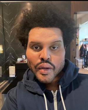 The Weeknd, desfigurat de botox în cel mai nou videoclip! Artistul și-a șocat toți fanii / FOTO