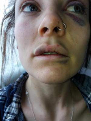 FOTO / Şocant! A fost bătută şi i s-a interzis să se machieze: "Nu există cuvinte să explic cât de groaznic este"