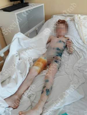 FOTO / Un copil de 9 ani a ajuns de urgență la spital, desfigurat de un ciobănesc german
