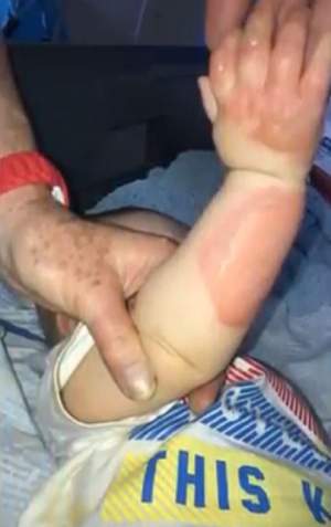 Imagini dramatice / Un bebeluş a ajuns la spital cu răni grave, după o greşeală banală. Atenţie, părinţi!