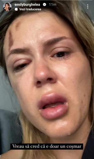Emily Burghelea a fost implicată într-un accident rutier! După imaginile șocante, influencerița a clarificat situația: ”Am filmat totul” / VIDEO