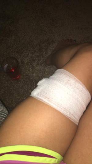 FOTO / Scene de coșmar! O tânără a fost înjunghiată în mijlocul nopții: ”Picioarele tale nu mai sunt așa frumoase acum”