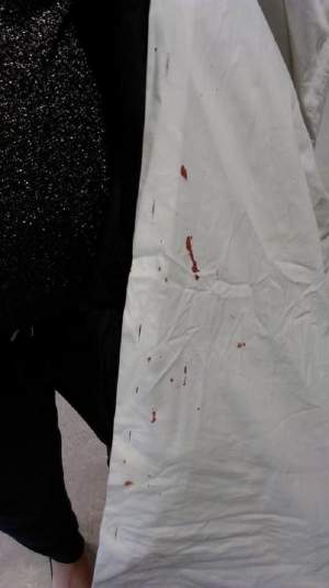 FOTO / Un adolescent ROMÂN bătut cu BRUTALITATE într-un liceu din Marea Britanie! ”L-au adus plin de sânge”