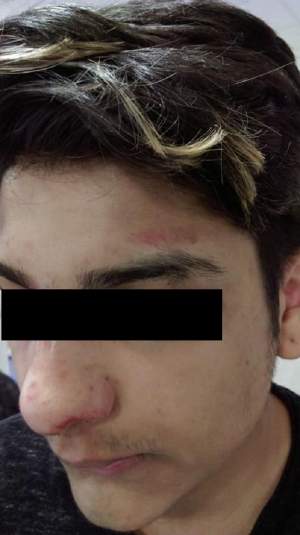 FOTO / Un adolescent ROMÂN bătut cu BRUTALITATE într-un liceu din Marea Britanie! ”L-au adus plin de sânge”