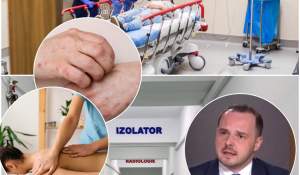 Ce simptome are lepra și cum se transmite. Două maseuze asiatice, care lucrează în Cluj, confirmate cu boala dispărută de aproape jumătate de secol