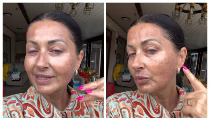 Gabriela Cristea a vorbit despre intervenția cu laser la față. Vedeta a explicat de ce are pete