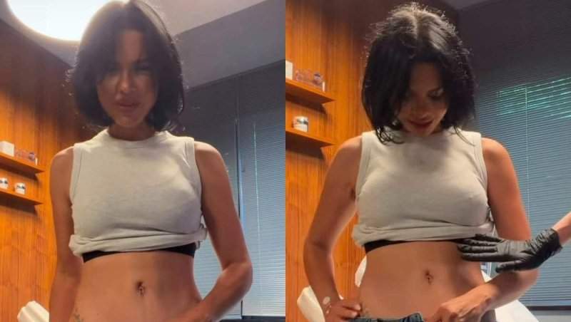 Andreea Popescu și-a arătat abdomenul după abdominoplastia reversă. Cum arată după intervenție