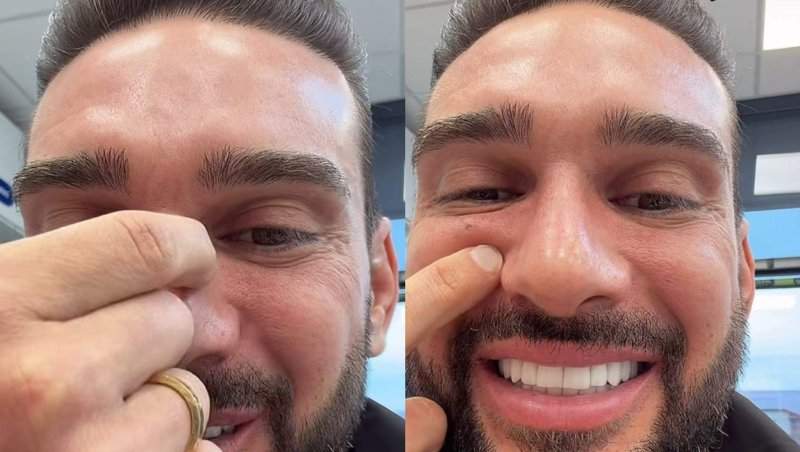 Dorian Popa nu și-a revenit după operația la nas! În ce stare se află: „Încă nu îl simt al meu”