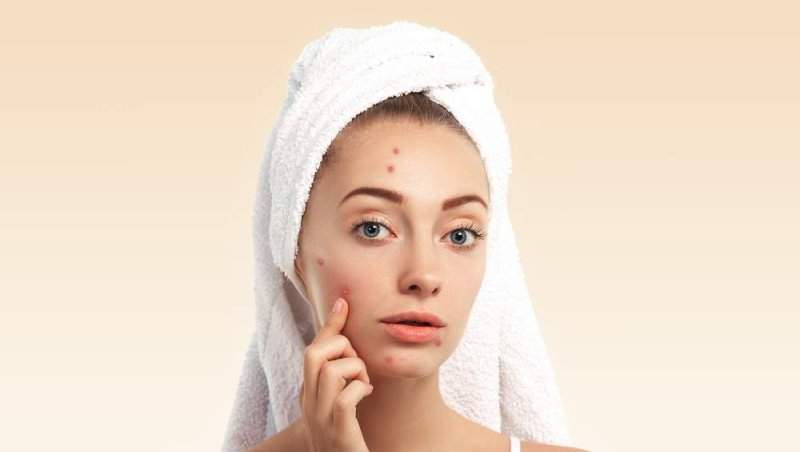 (P) Tenul predispus la acnee: cum alegi o rutină de îngrijire eficientă