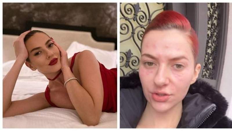 Lidia Buble a reacționat, după ce a fost criticată pentru că a apărut nemachiată. Cum le-a răspuns celor care au jignit-o că are nasul mare