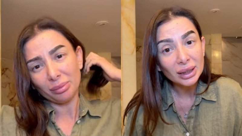 Influenceriță din România, mutată în America, anunț șocant: “Mi-a descoperit alunițe cancerigene!”