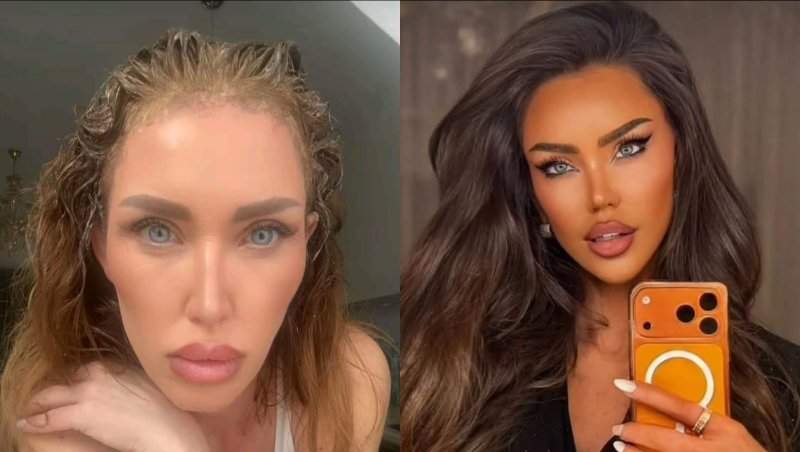 Sora Biancăi Drăgușanu s-a operat! Oana a apărut cu capul bandajat în întregime