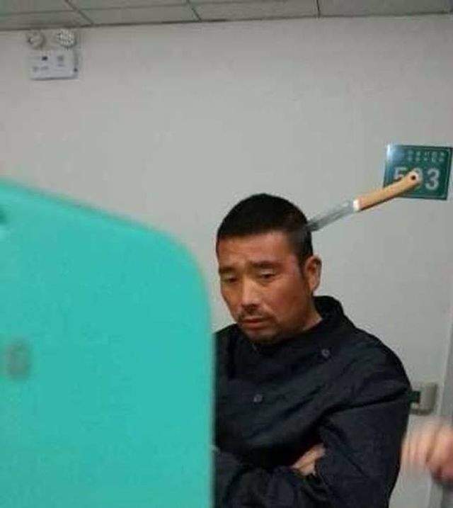 Un chinez a ajuns pe picioarele lui la spital cu un cuţit înfipt în cap! Foto HORROR