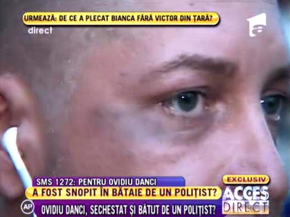 Ovidiu Danci a ajuns la urgenţe după ce a fost snopit în bătaie de poliţişti! Vezi ce i s-a întâmplat! / VIDEO