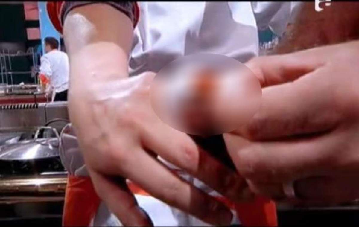 O concurentă de la "Top Chef" şi-a tăiat degetul. Reacţia colegilor a fost una inedită