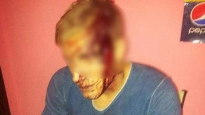 Un fotbalist a fost bătut şi lovit cu toporul în cap la Sălaj. Tânărul a ajuns la spital în urma altercaţiei cu un grup de romi
