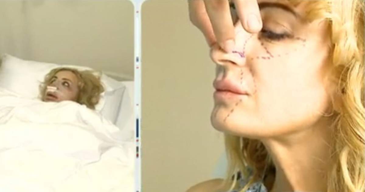 Daniela Gyorfi a intrat în "revizie" totală! Şi-a tăiat nasul, şi-a injectat grăsime din coapse în buze şi e desfigurată în ultimul hal / Foto