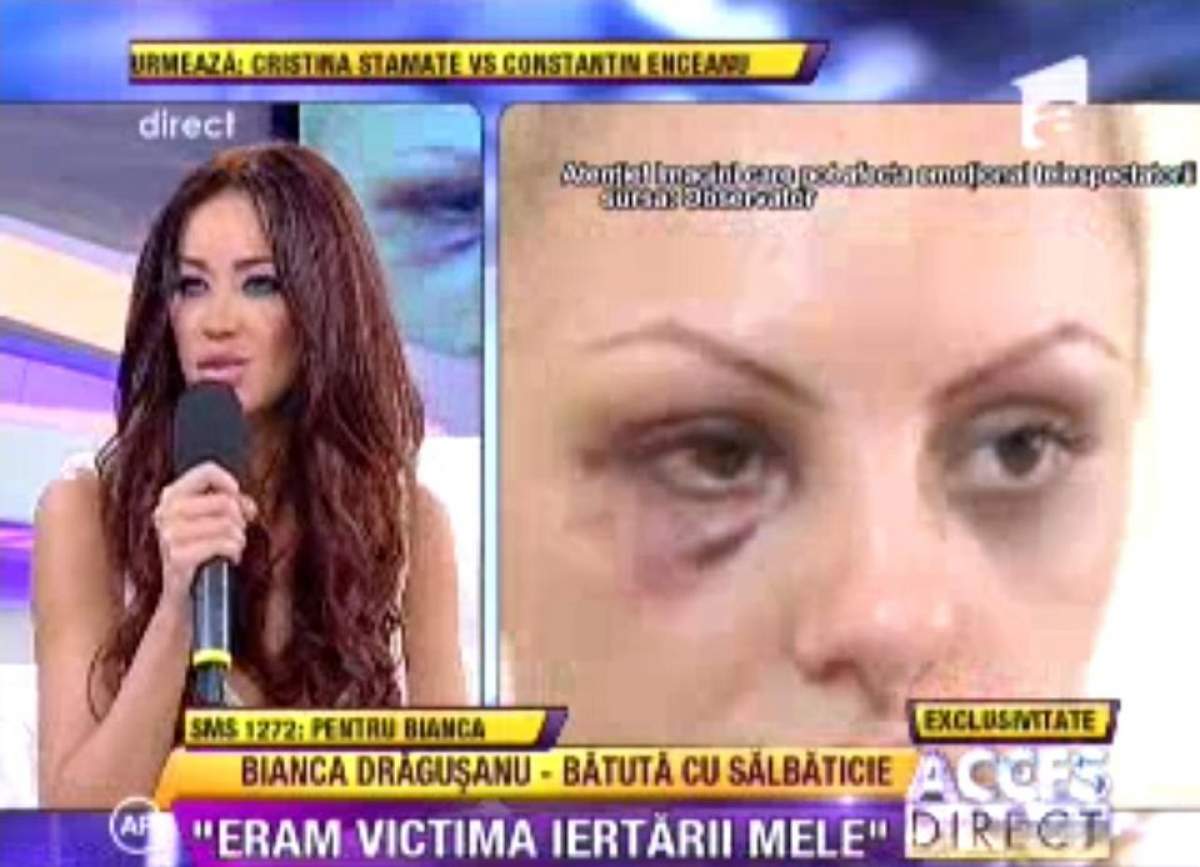 Şoc şi groază! Bianca Drăguşanu a fost bătută cu brutalitate la fel ca Alexandra Stan! "Mă doare din tot sufletul şi cu tot trupul"