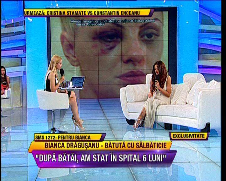 Şoc şi groază! Bianca Drăguşanu a fost bătută cu brutalitate la fel ca Alexandra Stan! "Mă doare din tot sufletul şi cu tot trupul"