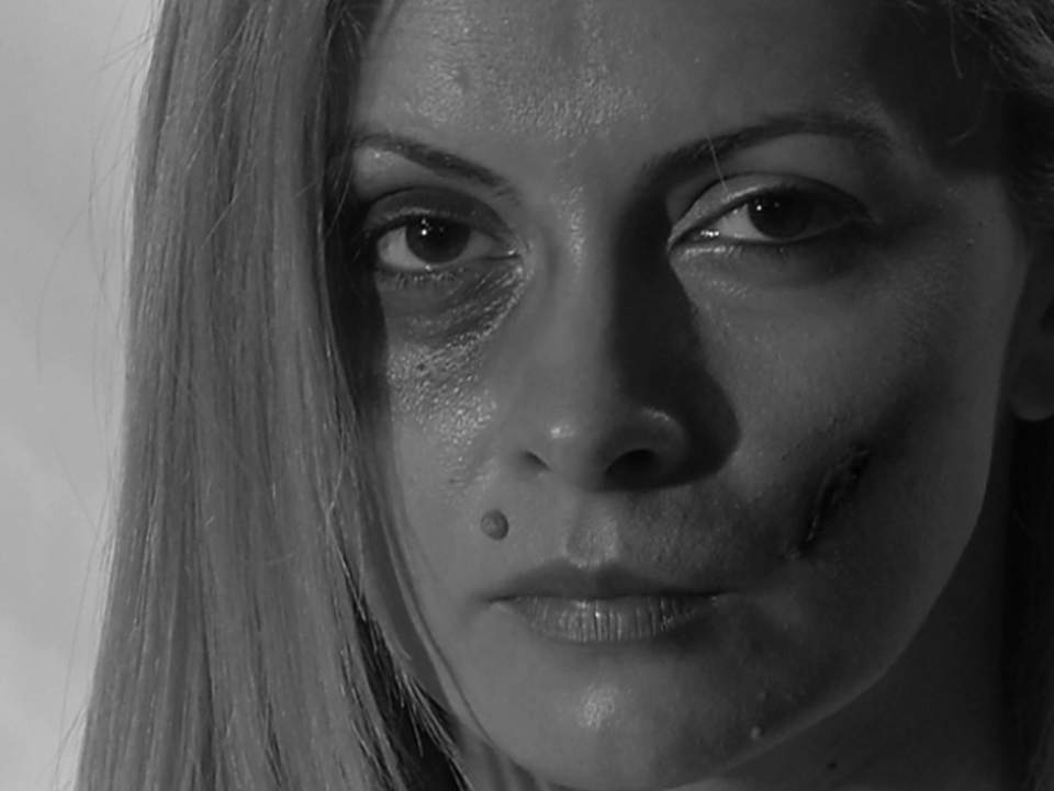 Simona Gherghe, plină de sânge şi desfigurată. Imagini horror cu moderatoarea "Acces direct" / Video EXCLUSIV