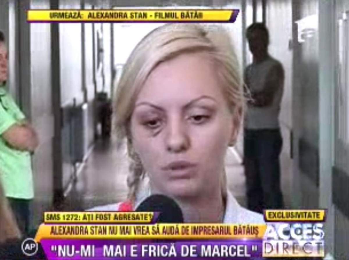 Alexandra Stan: "Sunt terfelită sufleteşte. Vânătaia trece, trauma rămâne"