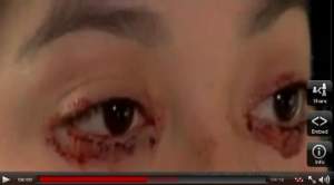 Aşa ceva nu ai mai văzut! O fată plânge cu lacrimi de sânge. Vezi cum e posibil! / Video