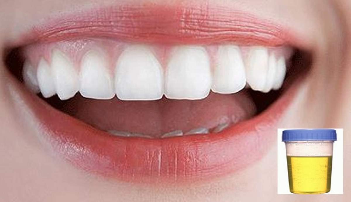 Cercetătorii pot să ne crească dinţii la loc folosind... urina!