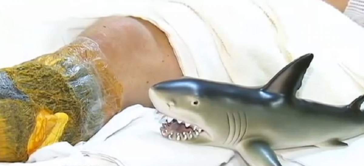 Urmărit de ghinioane! Un bărbat a fost muşcat de un rechin după ce a fost lovit de fulger! / VIDEO
