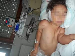 Kassandra Rotariu, un înger care se luptă cu viaţa! Fetiţa a trecut cu brio de a 34-a operaţie!