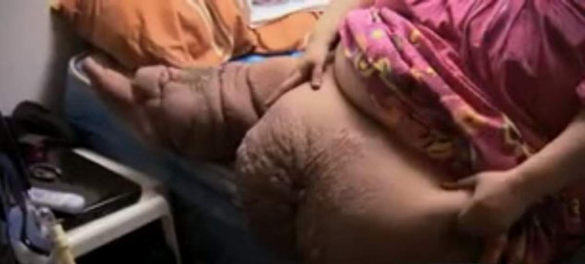 VIDEO ŞOCANT Are 272 de kilograme şi nu a mai ieşit din casă de doi ani! Cum arată femeia care e prizonieră în propriul corp