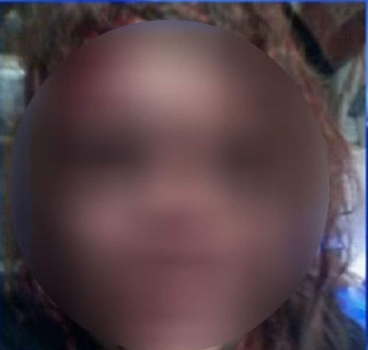 Facebook-ul a salvat-o! O femeie şi-a pus fotografia cu chipul desfigurat de soţ pe reţeaua de socializare unde a cerut ajutor