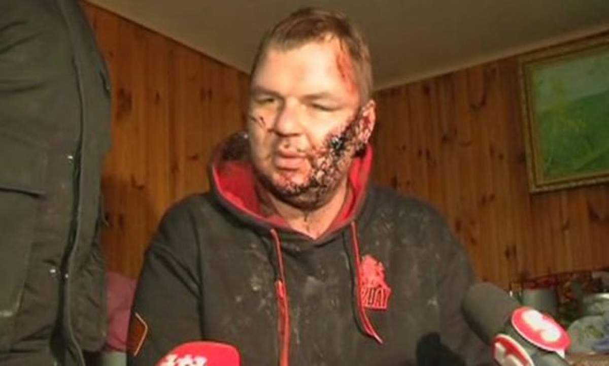 IMAGINI ŞOCANTE A fost mutilat pe viaţă: "M-au crucificat, mi-au crestat faţa şi tăiat o ureche". Motivul e revoltător