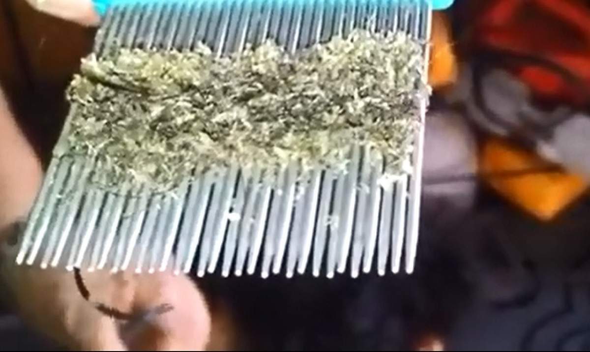 VIDEO/ Scârbos! O femeie a scos milioane de păduchi din capul fiicei ei!
