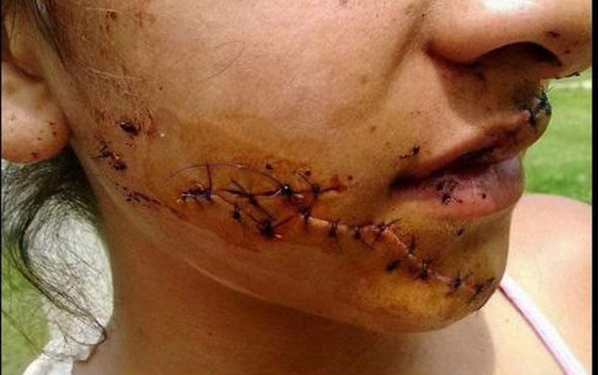 VIDEO / 18+ Gelozie de femeie! Julia Alvarez a rămas desfigurată, după ce două tinere au tăiat-o pe faţă şi pe corp