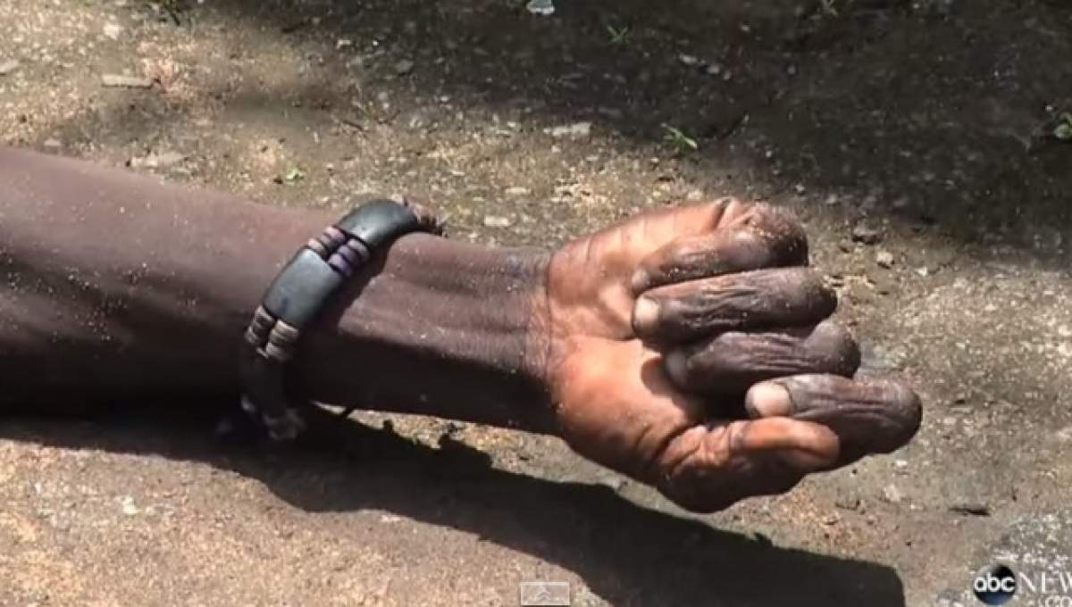 VIDEO / CAZ ŞOCANT! Infestat cu Ebola s-a trezit în sacul în care era transportat la crematoriu