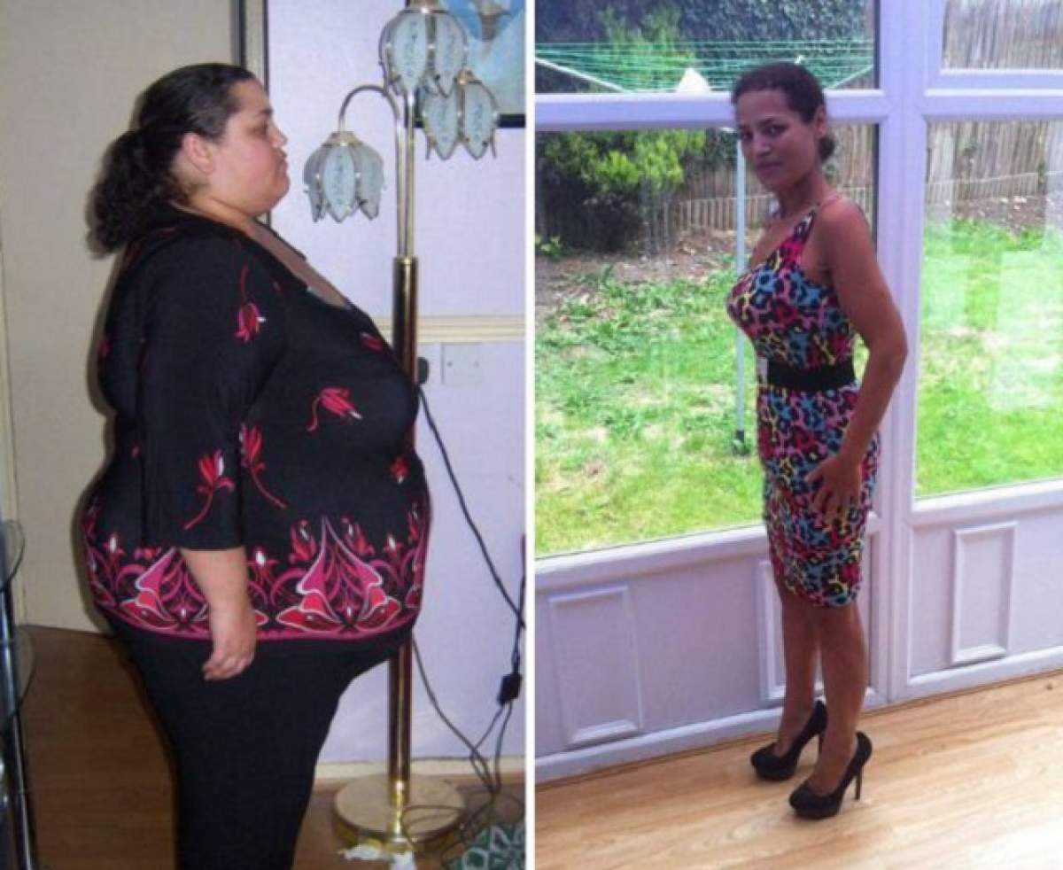 VIDEO/ O femeie obeză a slăbit 127 de kg după ce a refuzat să-şi micşoreze stomacul! Cum a reuşit