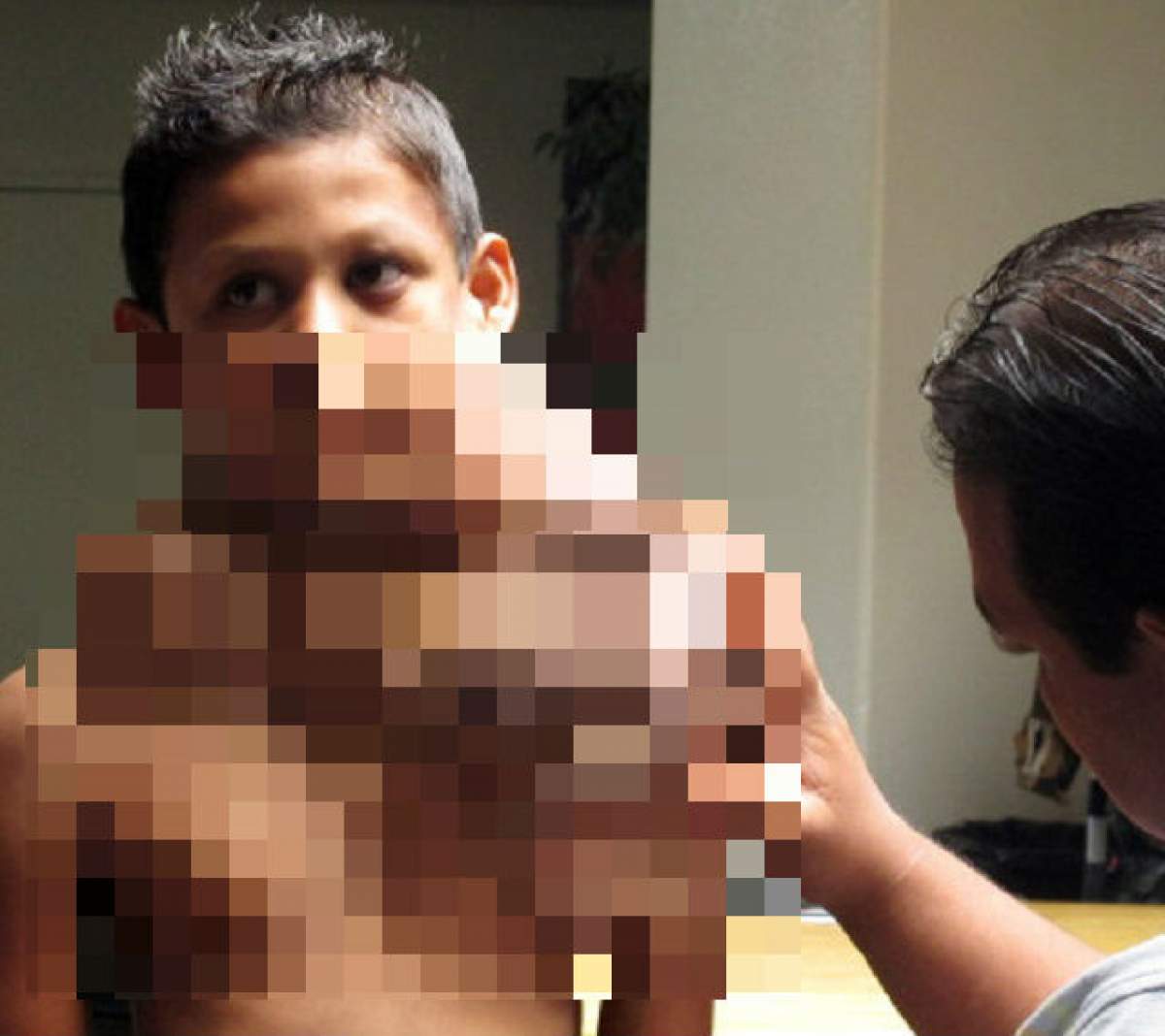 VIDEO/ Înspăimântător! Copil de 11 ani, cu o tumoră imensă în jurul gâtului