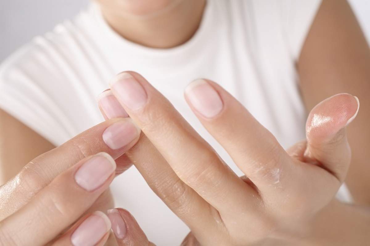 Culorile anormale ale unghiilor pot dezvălui dereglări ale organismului tău