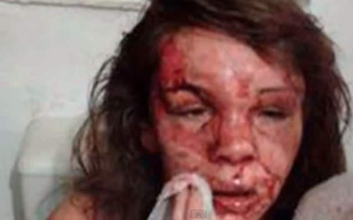 Imagini şocante! Un tânăr care seamănă cu Harry Potter a mutilat două fete, în plină stradă! Motivul e halucinant