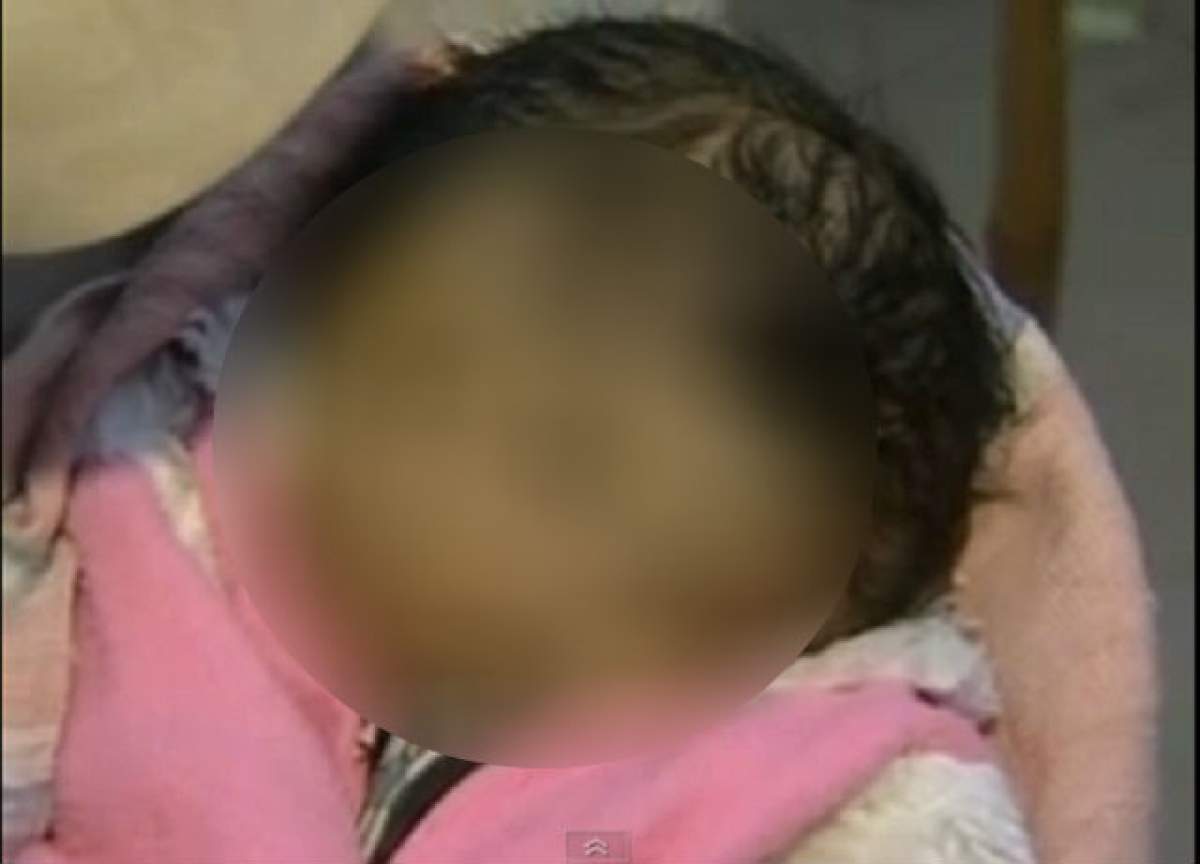 VIDEO Un caz TERIFIANT de malformaţie! Uite cum arată copilul cu două feţe!